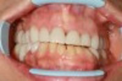 Img 6138 r05rky ijqylk - Eugenol