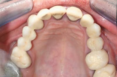 Img 6144 q0as3p - Eugenol