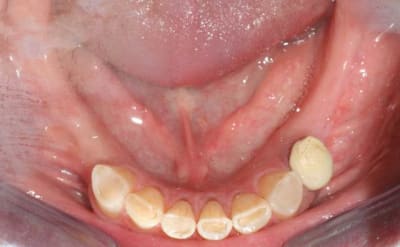 Img 6145 wqv7vl - Eugenol