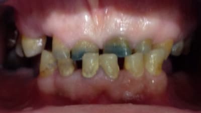 Img 6170 krimls - Eugenol