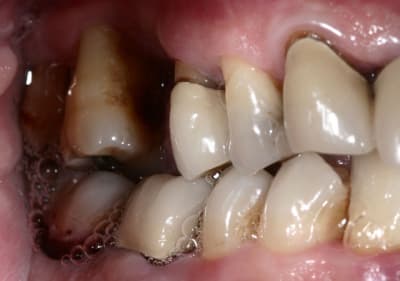 Img 6347 dxi7zd - Eugenol