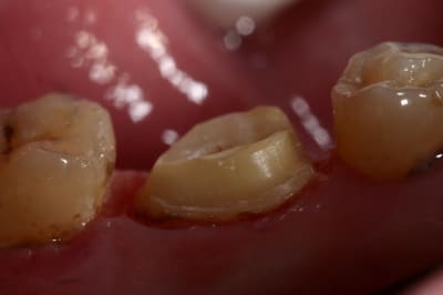Img 6497 ixm5mn - Eugenol