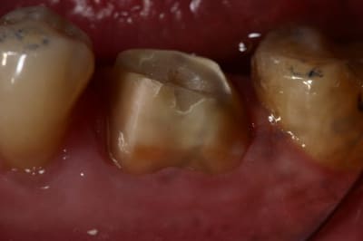 Img 6500 ftbhwt - Eugenol