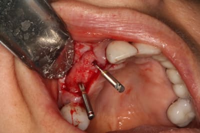 Img 6659 tzrty1 - Eugenol