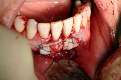 Img 6691 ewm28j - Eugenol