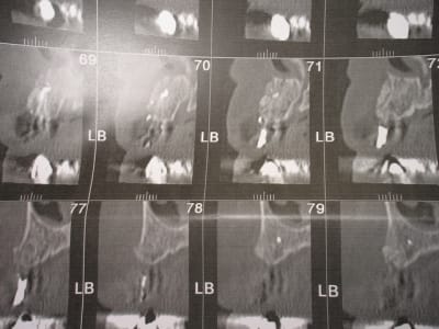 Img 6821 ivgmsh - Eugenol