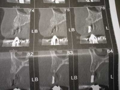 Img 6822 foirzr - Eugenol