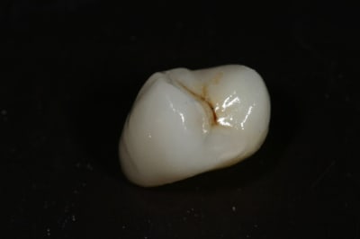 Img 6826 pdjmsw - Eugenol