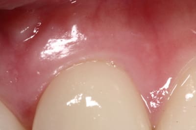 Img 6864 g9wfca - Eugenol