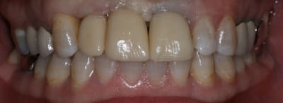 Img 6967 wmvy3w - Eugenol