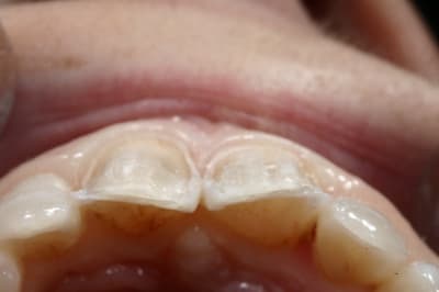 Img 6985 q6vhqu - Eugenol