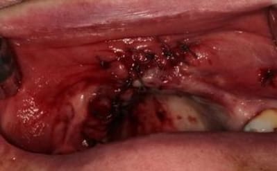 Img 7171 lnaqsl - Eugenol