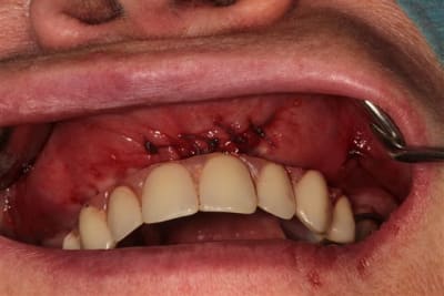 Img 7176 z2bgvk - Eugenol