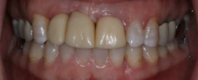 Img 7281 vx6qm4 - Eugenol