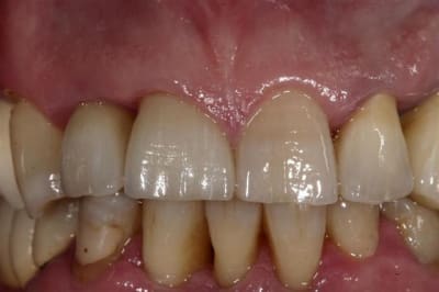 Img 7431  large  bhjpex - Eugenol