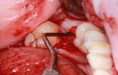 Img 7555r sbexhm - Eugenol
