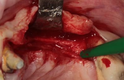 Img 7579r l1igj5 - Eugenol