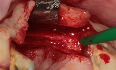 Img 7580r rikdev - Eugenol