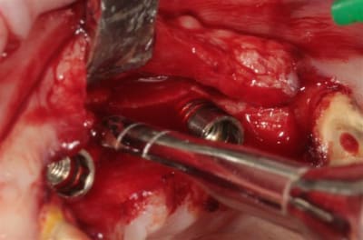 Img 7584 z8ofuh - Eugenol