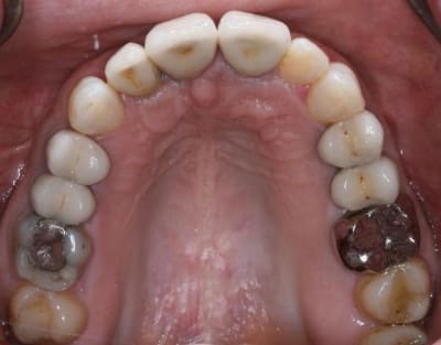 Img 7625 jc9fcr - Eugenol