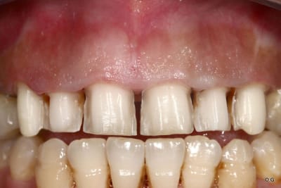 Img 7733 cnwano - Eugenol