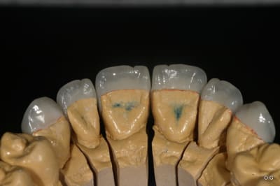 Img 7763 xnmyxj - Eugenol