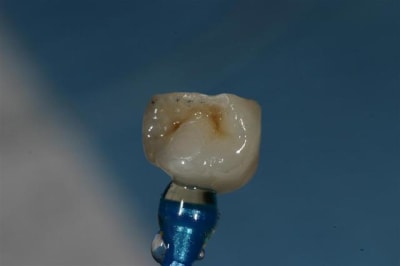 Img 8466  large  sq4xvt - Eugenol