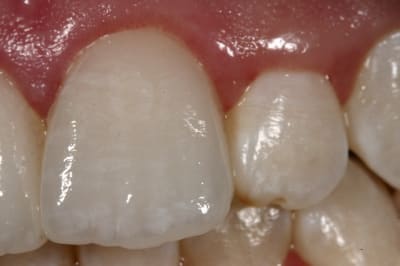 Img 8779 nhszfg - Eugenol