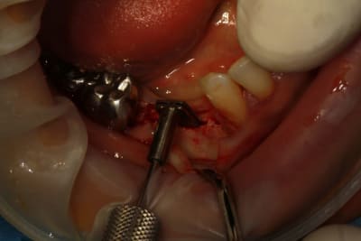Img 8827 fo8ytm - Eugenol