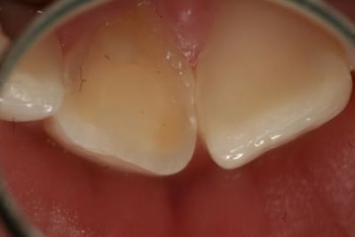 Img 8860 kejfp5 - Eugenol