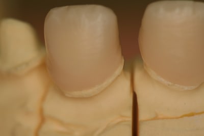 Img 8898 liqnfk - Eugenol