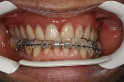 Img 8 zguxl9 - Eugenol