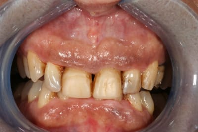 Img 9231 savtqx - Eugenol