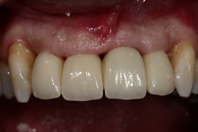 Img 9489 ghot1m - Eugenol