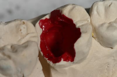 Img 9539 zdkxs6 - Eugenol