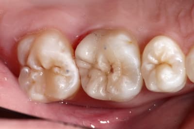 Img 9542 tjydqh - Eugenol