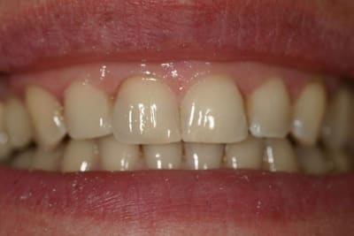 Img 95592 niwbqj - Eugenol