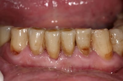 Img 9695 sm9nk3 - Eugenol