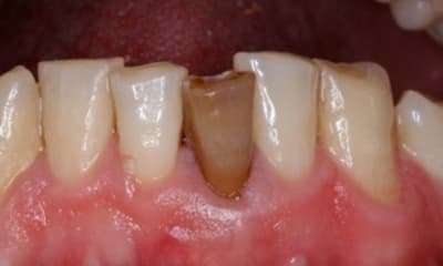 Img 9718 jpmkue - Eugenol