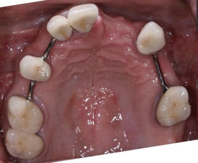 Img ic2 z6pjbu - Eugenol