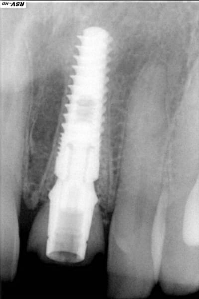 Interactive dx8dv8 - Eugenol