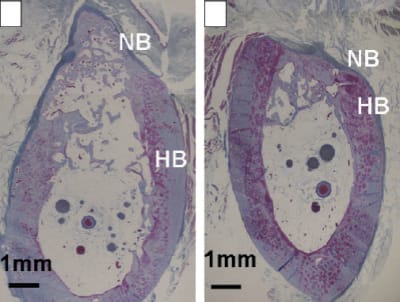 Infuse bonegraft xkrga5 - Eugenol