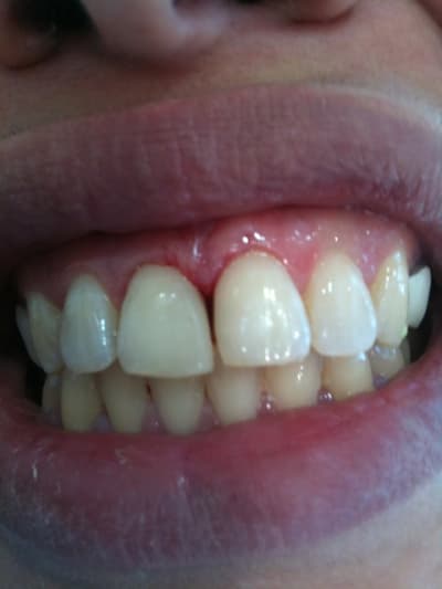 Iphone 071 iwe99h - Eugenol