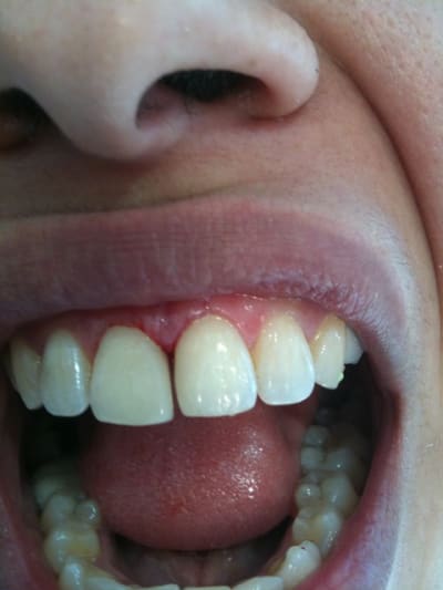 Iphone 072 qunl1p - Eugenol