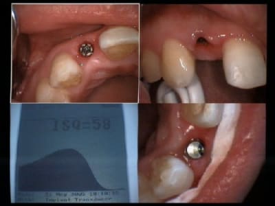 Isq qui augmente nknxno - Eugenol