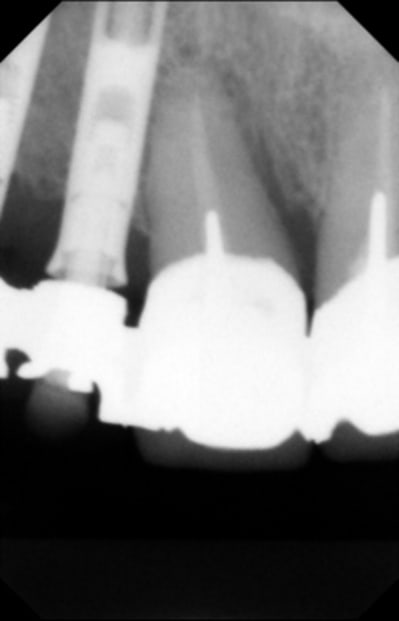 Image000 lbmca0 - Eugenol