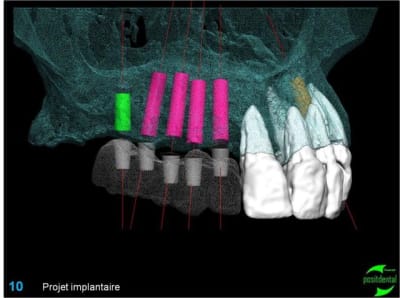 Image10 sievch - Eugenol