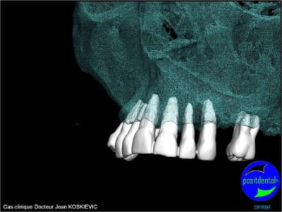 Image12 dpljae - Eugenol