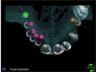 Image12 xgz16q - Eugenol