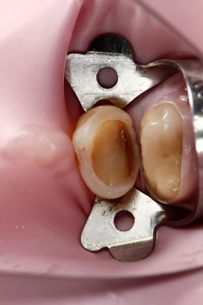 Image15 feyseq - Eugenol